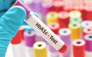 Chỉ số HbA1c là 6.4% có mắc đái tháo đường không?