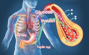Chế độ ăn cho người bị rối loạn dung nạp glucose?