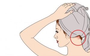 Phiền phức hơn cả gàu, phải trị vảy da đầu thế nào?