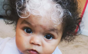 Trẻ có tóc bạc: Nguyên nhân khiến tóc bạc sớm và cách khắc phục