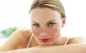 Điểm mặt các phương pháp trị liệu lupus ban đỏ hệ thống