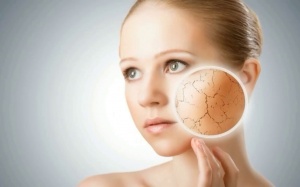 6 loại mặt nạ dành cho da khô trong mùa Hè