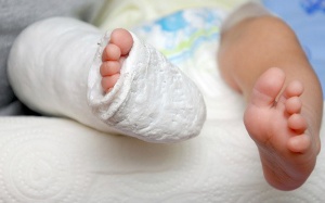 Chăm sóc trẻ bó bột tại nhà như thế nào?