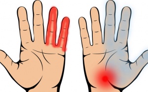 Nhận biết bệnh nguy hiểm qua những dấu hiệu ở bàn tay