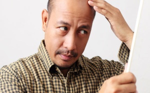 Những cách giúp cải thiện tình trạng hói trán hiệu quả