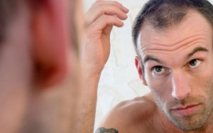 Mẹo ngăn ngừa rụng tóc và hói đầu ở nam giới