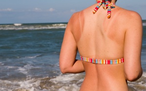 Da bị cháy nắng trong mùa Hè: 5 cách điều trị tự nhiên và đơn giản