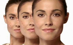 Video: Cách làm mờ đốm đồi mồi trên da không thể dễ dàng hơn!