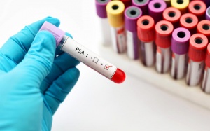 Xét nghiệm máu giúp phát hiện sớm loại ung thư 'ám ảnh' cánh đàn ông