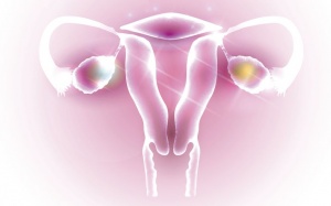 7 dấu hiệu cảnh báo hội chứng buồng trứng đa nang