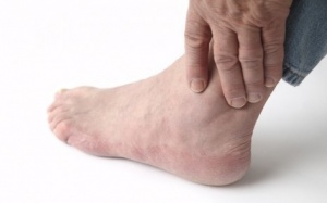 Vì sao vết thương của người bệnh đái tháo đường khó lành?