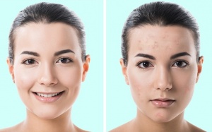 7 sản phẩm làm đẹp bác sỹ khuyên bạn không nên dùng