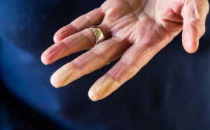 12 nguyên nhân thường gặp khiến bạn bị tê tay