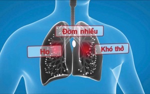 Bị giãn phế quản phổi phải làm sao?
