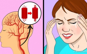 Cảnh báo 7 dấu hiệu cho thấy bạn đang ăn quá nhiều muối