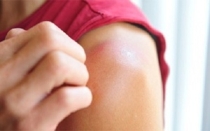 Ngứa ngoài da - triệu chứng không ngờ của 6 bệnh nguy hiểm