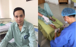 Hoại tử bàn chân do lơ là trong việc điều trị đái tháo đường