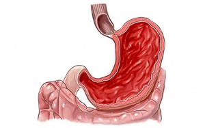 Cách điều trị và ngăn ngừa viêm dạ dày ruột do vi khuẩn