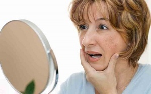 Bí quyết trị nám da cho phụ nữ tuổi trung niên