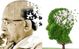 Vì sao người mắc bệnh Alzheimer dễ tử vong?