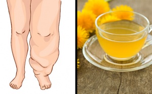 Những thực phẩm và đồ uống tự nhiên giúp giảm chứng phù nề, giữ nước