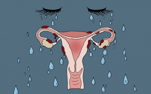 Rối loạn tâm thần tiền kinh nguyệt có thể dẫn tới tự tử