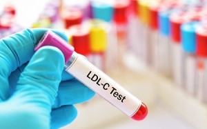 Cholesterol cao có thể ảnh hưởng đến khả năng sinh sản của phụ nữ