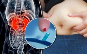 Video: Làm thế nào để xác định nguy cơ mắc đái tháo đường type 2?