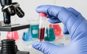 Xét nghiệm máu mang tính đột phá giúp phát hiện sớm u ác tính