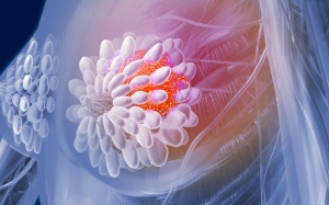 7 cách tốt nhất ngăn ngừa ung thư vú đã được khoa học chứng minh