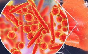 Mycoplasma - không hẳn là vi khuẩn vô hại