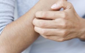 Làm thế nào để ngăn ngừa côn trùng đốt trong mùa Hè?