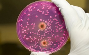 Điều trị nhiễm mycoplasma như thế nào?