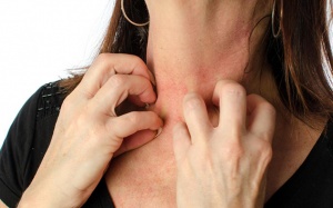 Vẩy phấn hồng là bệnh gì?