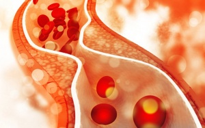 “Giải oan” cho cholesterol: Cholesterol không phải nguyên nhân gây bệnh tim mạch