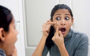 4 cách đơn giản giúp trị mụn cho người da nhờn