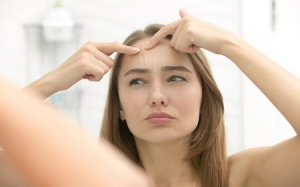 3 điều cần ghi nhớ để đối phó với mụn trứng cá dễ dàng