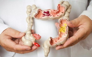 3 loại ung thư đường tiêu hóa dễ mắc phải nhất mà bạn cần cảnh giác