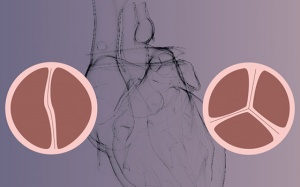 8 điều bạn nên biết về bệnh van tim