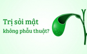 Có thể trị sỏi mật mà không cần phẫu thuật?