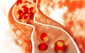 4 quan niệm sai lầm về chế độ ăn uống người bị cholesterol cao hay mắc