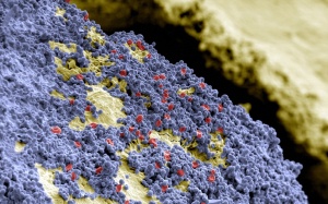 Kinh ngạc với những hình ảnh cận cảnh vi khuẩn bám trên răng của bạn