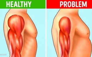 Nhận biết 8 dấu hiệu sớm của bệnh loạn dưỡng cơ
