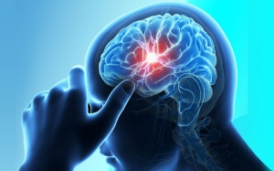 Đột quỵ làm tăng gấp đôi nguy cơ mắc chứng sa sút trí tuệ