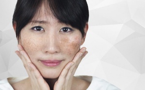 Làm cách nào để da không nám sạm?