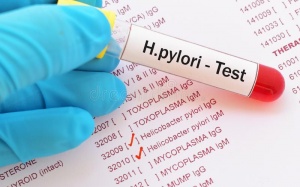 Có cần xét nghiệm H. pylori trước khi dùng thuốc điều trị bệnh dạ dày? 