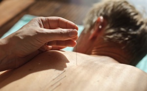 Châm cứu giúp giảm đau và trầm cảm sau đột quỵ