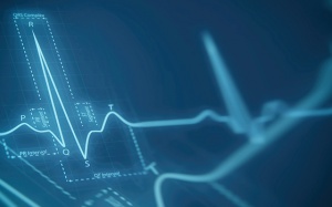 Đốt điện tim có điều trị được dứt điểm rối loạn nhịp?