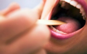 5 việc nên làm nếu không muốn bị ung thư miệng