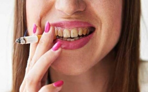 Những 'thủ phạm' khiến răng ố vàng